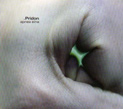 Pridon